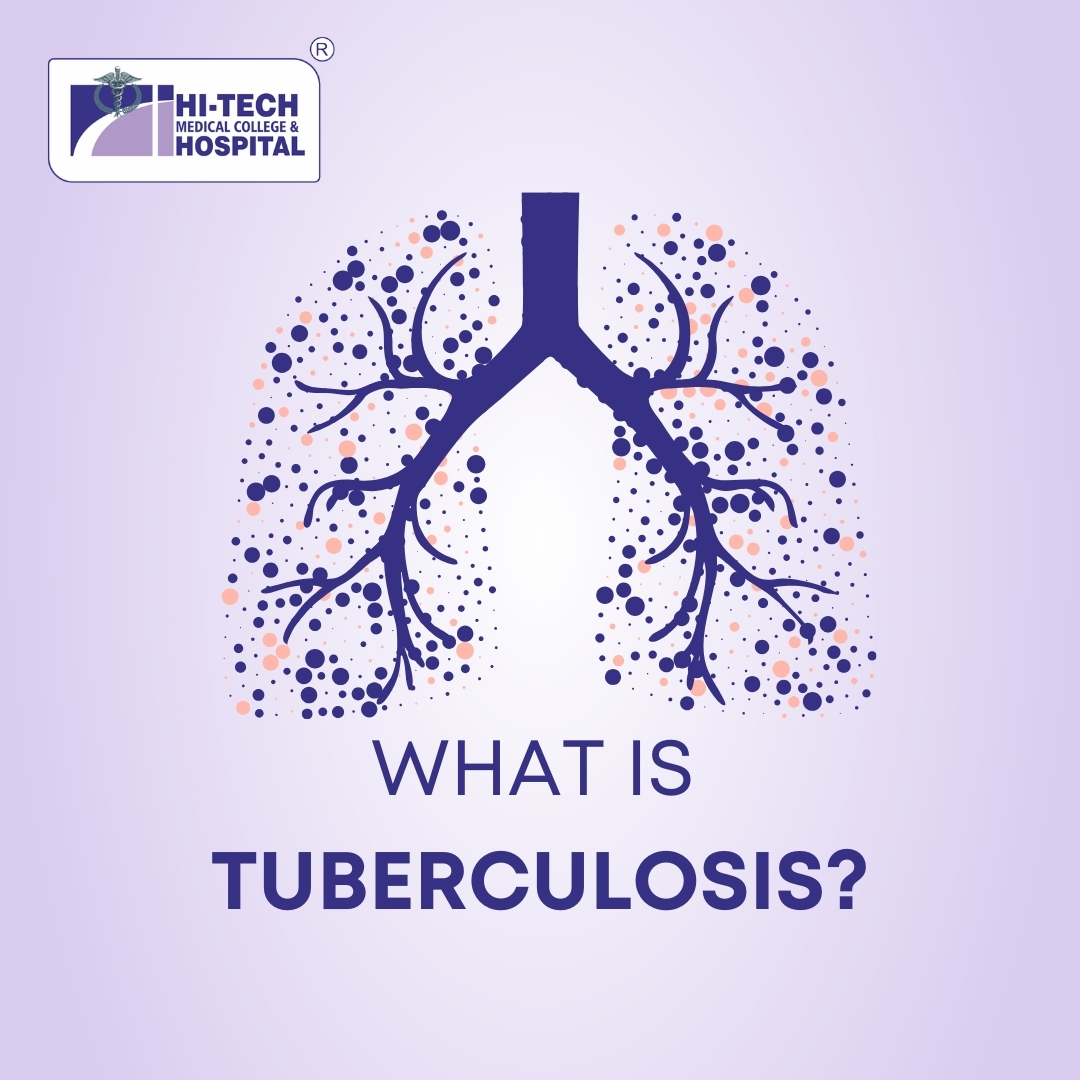 how to prevent tuberculosis